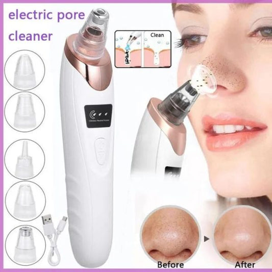 Blackhead Vacuum Pore Cleaner – Electric Deep Cleansing Suction Tool for Face & Nose | Rechargeable Acne Remover & Skin Care Device for Clear Glowing Skin.